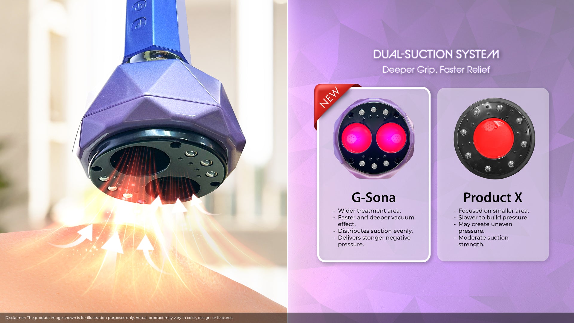 G-Sona (GINTELL X Dion)